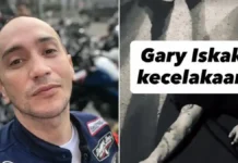 Aktor Gary Iskak Meninggal Dunia Usai Alami Kecelakaan, Begini Kronologinya!